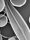 Navicula P 0007 Navicula Diatoms 2